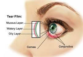 eyes disease --- 4b