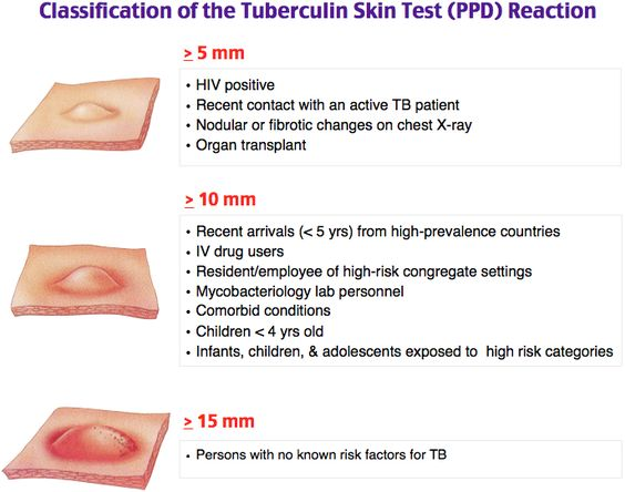 TB Skin Test: Phát Hiện và Hiểu Rõ Về Bệnh Lao Qua Xét Nghiệm Da